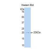 abx103028