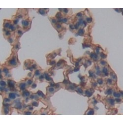 Interleukin 3 Receptor alpha (IL3RA) Antibody