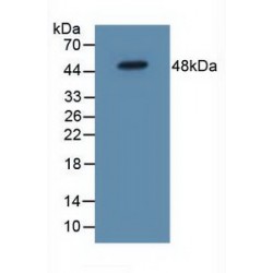 Interleukin 5 Receptor alpha (IL5RA) Antibody