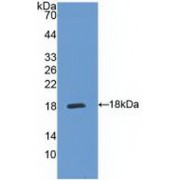 Western blot analysis of recombinant Human IL5Ra.