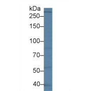 Western blot analysis of Human Lung lysate, using Human LRRK2 Antibody (2 µg/ml) and HRP-conjugated Goat Anti-Rabbit antibody (<a href="https://www.abbexa.com/index.php?route=product/search&amp;search=abx400043" target="_blank">abx400043</a>, 0.2 µg/ml).