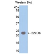 Western blot analysis of the recombinant protein.