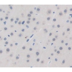 Leucine Rich Repeat Kinase 2 (LRRK2) Antibody