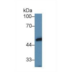 Ly1 Antibody Reactive Homolog (LYAR) Antibody