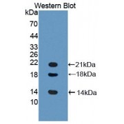 Western blot analysis of recombinant Mouse LYAR Protein.