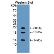 Western blot analysis of recombinant Mouse LYAR Protein.