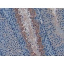 Ly1 Antibody Reactive Homolog (LYAR) Antibody