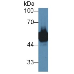 Ly1 Antibody Reactive Homolog (LYAR) Antibody