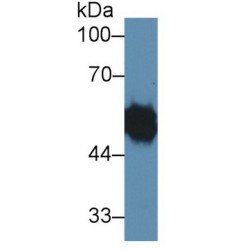 Ly1 Antibody Reactive Homolog (LYAR) Antibody