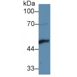 Ly1 Antibody Reactive Homolog (LYAR) Antibody