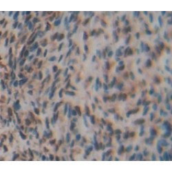 Ly1 Antibody Reactive Homolog (LYAR) Antibody