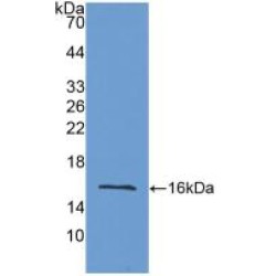 Lysyl Oxidase Like Protein 2 (LOXL2) Antibody