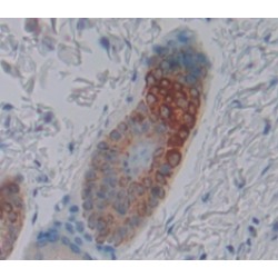 Lysyl Oxidase Like Protein 2 (LOXL2) Antibody