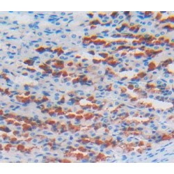Lysyl Oxidase Like Protein 2 (LOXL2) Antibody