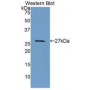 Western blot analysis of recombinant Mouse LOXL3.