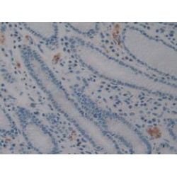 Neural Cell Adhesion Molecule (NCAM) Antibody