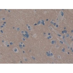 Neural Cell Adhesion Molecule (NCAM) Antibody