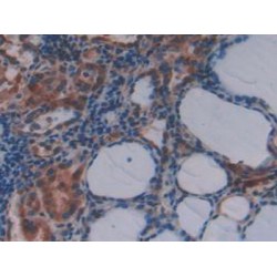 N-Methylpurine DNA Glycosylase (MPG) Antibody