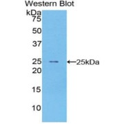 Western blot analysis of the recombinant protein.