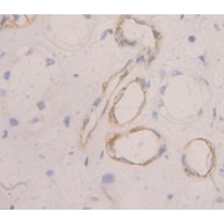 Peripheral Myelin Protein 22 (PMP22) Antibody