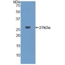 Phosphofructokinase, Platelet (PFKP) Antibody