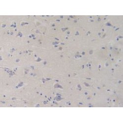 Phosphofructokinase, Platelet (PFKP) Antibody