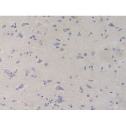 Phosphofructokinase, Platelet (PFKP) Antibody