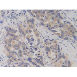 Phosphofructokinase, Platelet (PFKP) Antibody