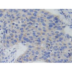 Phosphofructokinase, Platelet (PFKP) Antibody