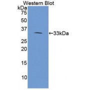 Western blot analysis of the recombinant Human PLA2R1 Protein.