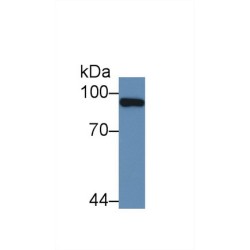 Promyelocytic Leukemia Protein (PML) Antibody