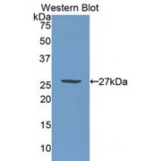 Western blot analysis of recombinant Human PML Protein.