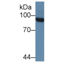 Promyelocytic Leukemia Protein (PML) Antibody