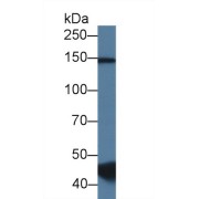 WB analysis of Pig Skeletal muscle lysate, using Human RNA-Binding Protein 20 (RBM20) Antibody (1.5 µg/ml) and HRP-conjugated Goat Anti-Rabbit antibody (<a href="https://www.abbexa.com/index.php?route=product/search&amp;search=abx400043" target="_blank">abx400043</a>, 0.2 µg/ml).