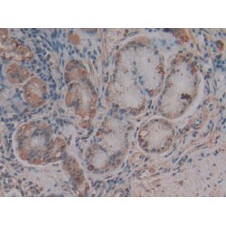 Stromal Cell-Derived Factor 1 / SDF1 (CXCL12) Antibody