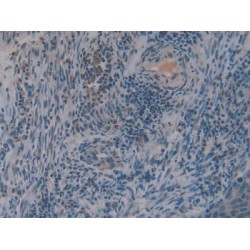 Stromal Cell-Derived Factor 1 / SDF1 (CXCL12) Antibody