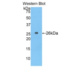 Stromal Cell Derived Factor 4 (SDF4) Antibody