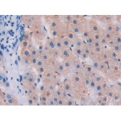 Sulfatase Modifying Factor 1 (SUMF1) Antibody