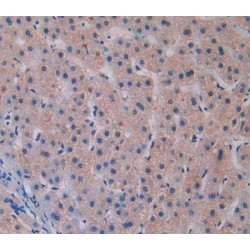 Sulfatase Modifying Factor 1 (SUMF1) Antibody