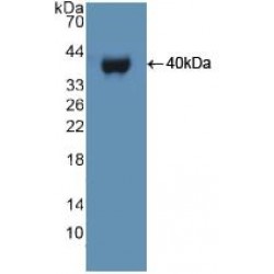 Ubiquitin Protein Ligase E3A (UBE3A) Antibody