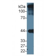 Western blot analysis of Mouse Heart lysate, using Human ACTC1 Antibody (1 µg/ml) and HRP-conjugated Goat Anti-Rabbit antibody (<a href="https://www.abbexa.com/index.php?route=product/search&amp;search=abx400043" target="_blank">abx400043</a>, 0.2 µg/ml).