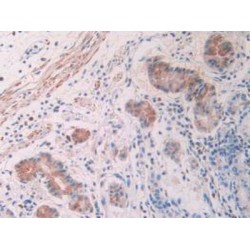 Activin A Receptor Type 2A (ACVR2A) Antibody
