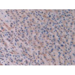 Activin A Receptor Type 2A (ACVR2A) Antibody