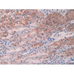 Activin A Receptor Type 2A (ACVR2A) Antibody