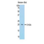 Western blot analysis of the recombinant protein.
