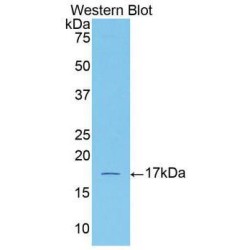 Activin A Receptor Type 2A (ACVR2A) Antibody