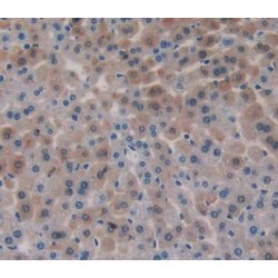 Activin A Receptor Type 2B (ACVR2B) Antibody