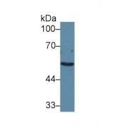 Western blot analysis of Human Liver lysate, using Human ADRa1A Antibody (2 µg/ml) and HRP-conjugated Goat Anti-Rabbit antibody (<a href="https://www.abbexa.com/index.php?route=product/search&amp;search=abx400043" target="_blank">abx400043</a>, 0.2 µg/ml).