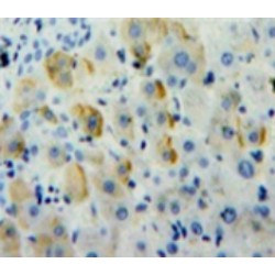 Adrenergic Receptor Alpha 1A (ADRa1A) Antibody