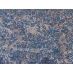 Angiopoietin-Related Protein 1 (ANGPTL1) Antibody
